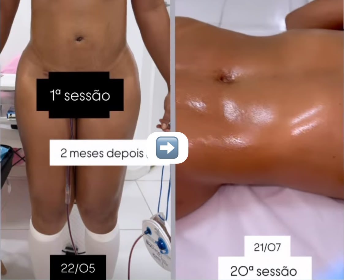 Resultado de tratamento acompanhado por Andréa Andrade